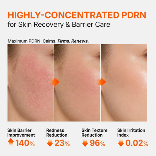 Genabelle PDRN 3% Hyper Boost Ampoule 40ml-Wonder Skin