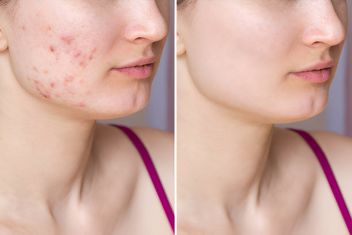 Kompletter K-Beauty-Leitfaden | Wonder Skin