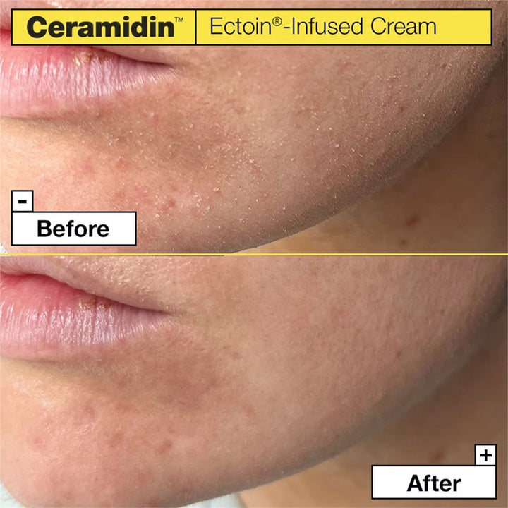 Ceramidin Ectoin-angereicherte Creme | Wonder Skin