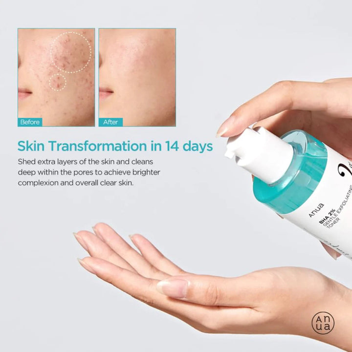 Sanftes Peeling-Toner | Wonder Skin