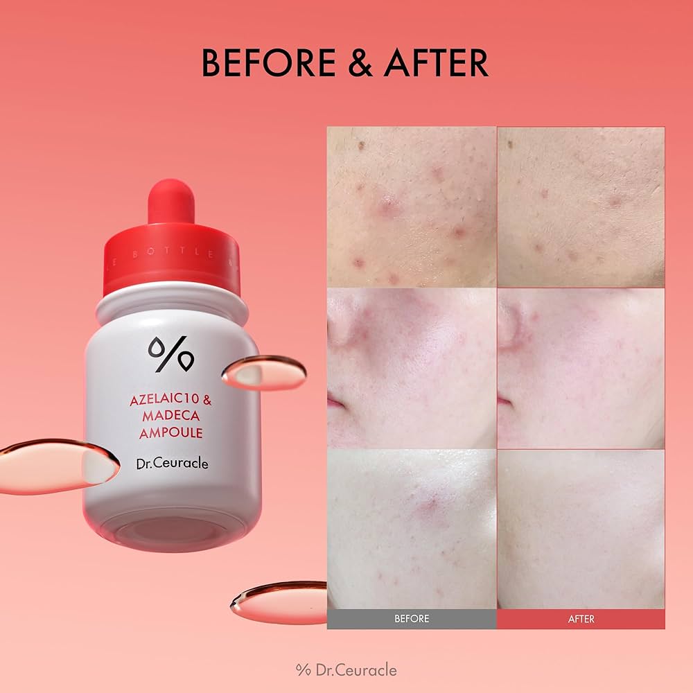 Dr. Ceuracle Azelaic 10 & Madeca Ampoule 30ml – Flasche mit Etikett in der Detailansicht