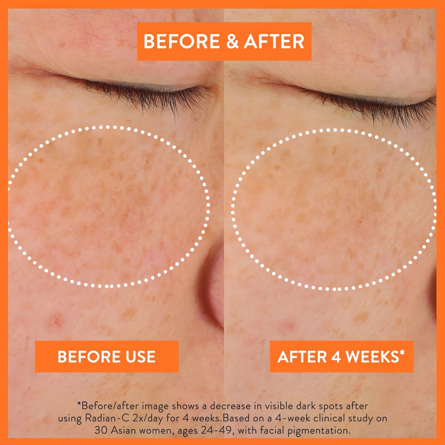 Laneige - Radian-C Cream - 30ml-Wonder Skin