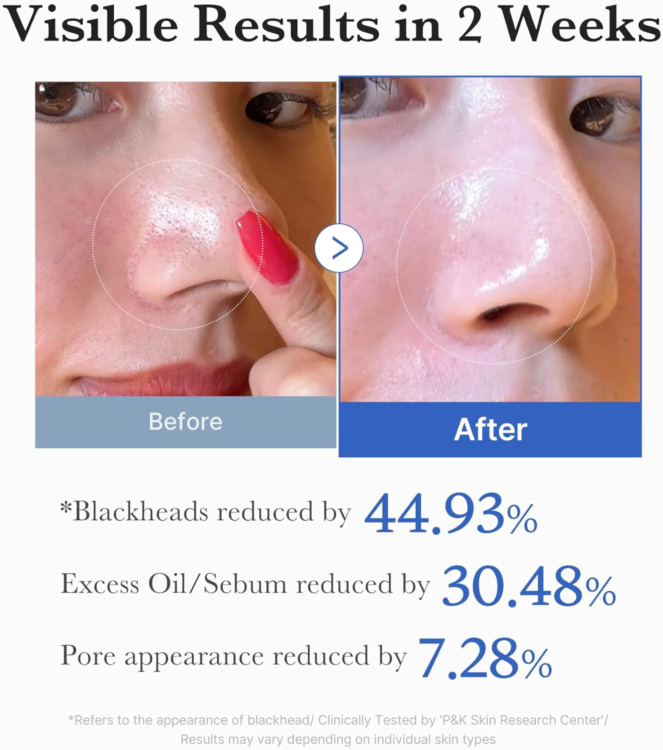 Medicube Zero Pore Pad 2.0 (70St.)-Wonder Skin