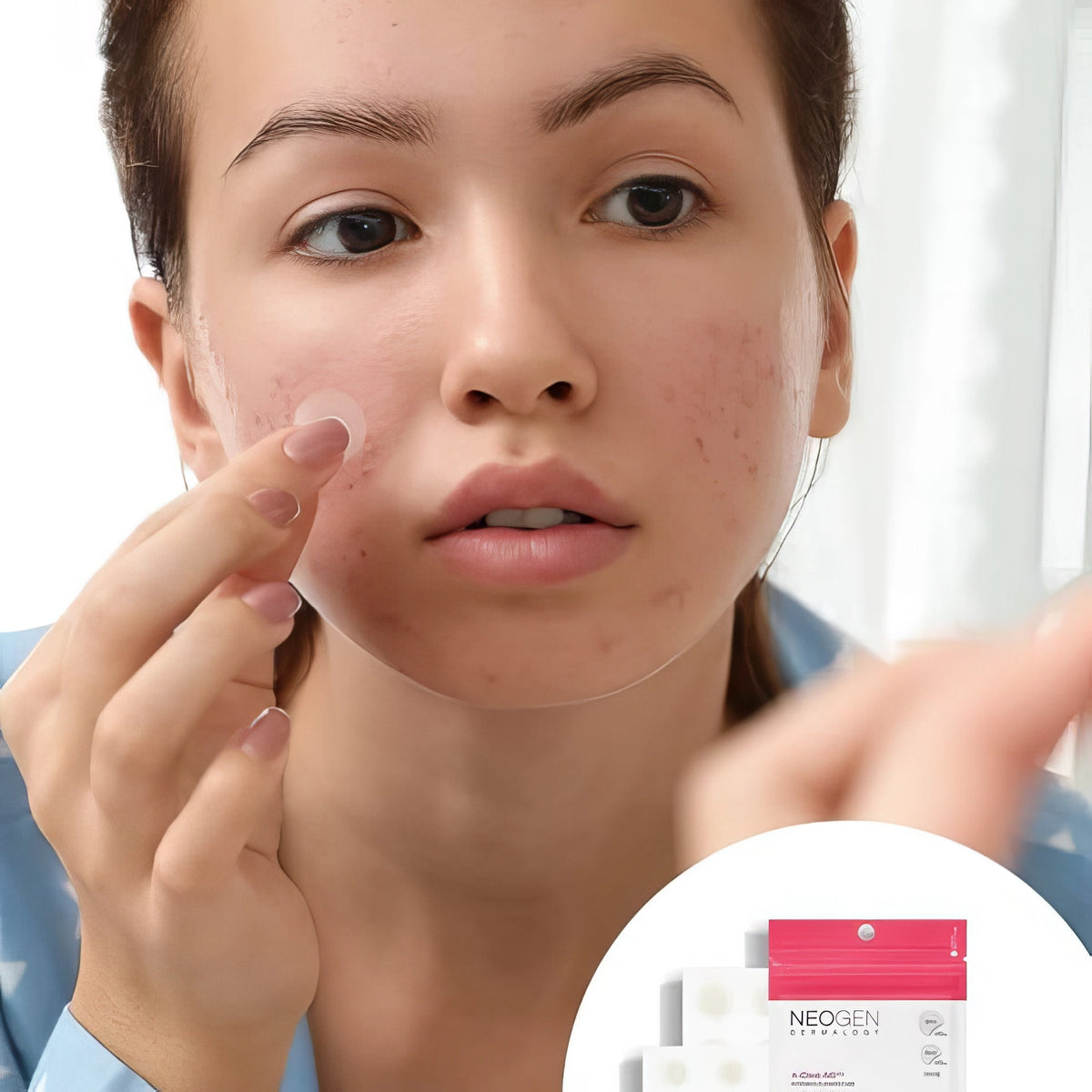 Neogen Dermalogy A-Clear Soothing Spot Patch 24St. – Hand hält weiße Flasche mit Pipette und grünlich-gelber Flüssigkeit